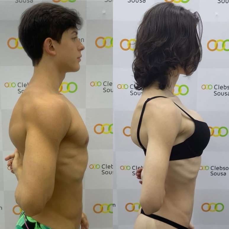 Bella Longuinho compartilha antes e depois de sua transi&ccedil;&atilde;o de g&ecirc;nero