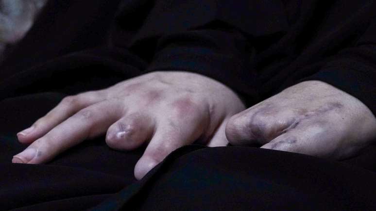 As m&atilde;os de Nayfe ficaram gravemente feridas no ataque