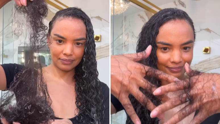 Postpartum Hair Fall: you understand Lucy Ramos’s condition and how to treat