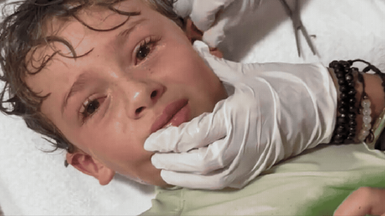 Video: son of influencer has a living crab taken from the ear after going to the beach