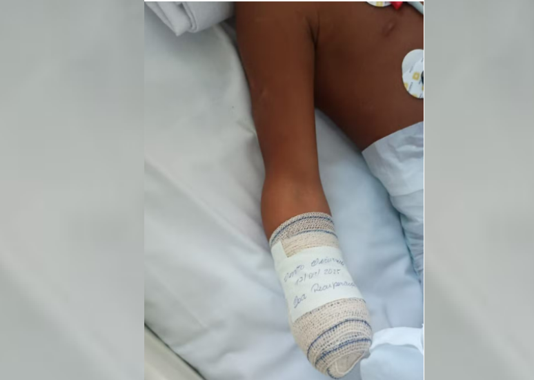 The boy loses his hand and fingers after an explosion of artifact in RJ