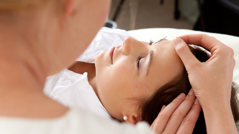 Muito utilizada como alternativa ao botox, a acupuntura facial estimula a produção de colágeno, ajudando a suavizar linhas de expressão