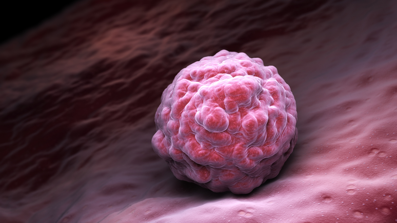 Donation of the bone marrow: what it is and how to do