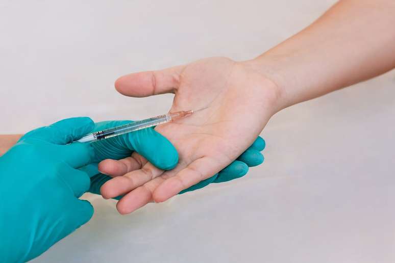 Hyperidosis: excessive sweat in the hands