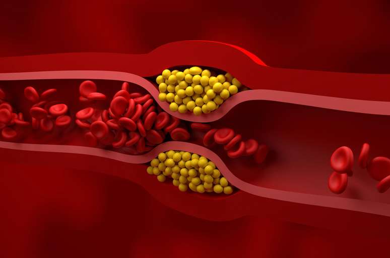 Cholesterol obtains the category for “extreme risk” in a new guideline