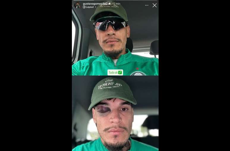 Gustavo G&oacute;mez mostrou les&atilde;o nas suas redes sociais &ndash;