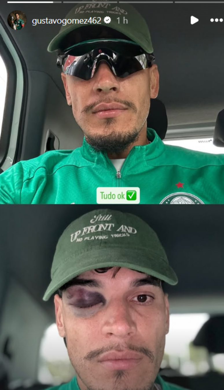 G&oacute;mez fez postagem no Instagram