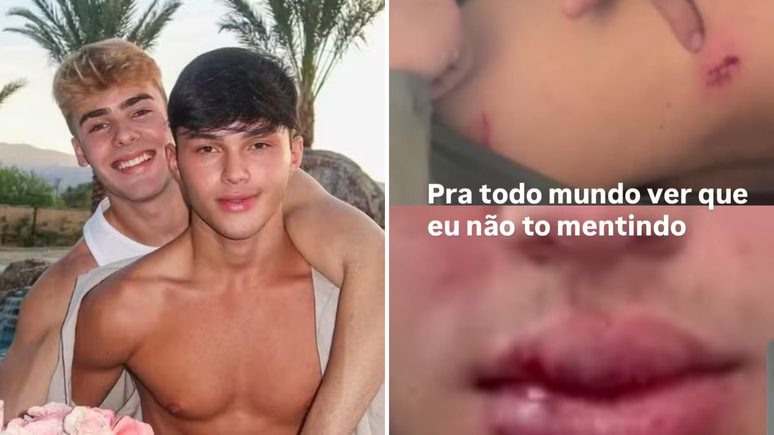 The influencer Luan Alencar says the son was beaten by his boyfriend: “passed out”