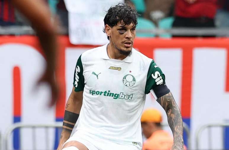 Gómez afirma que não jogou no sacrifício após olho roxo – Gómez afirma que não jogou no sacrifício após olho roxo –
