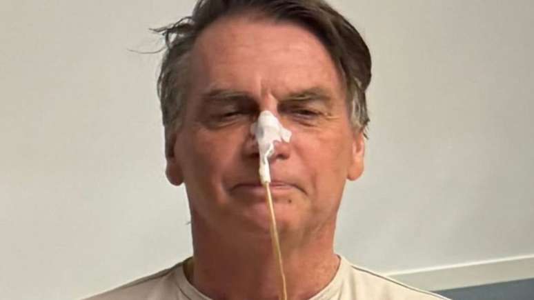 Jair Bolsonaro solicitou autorização ao STF para realizar cirurgia