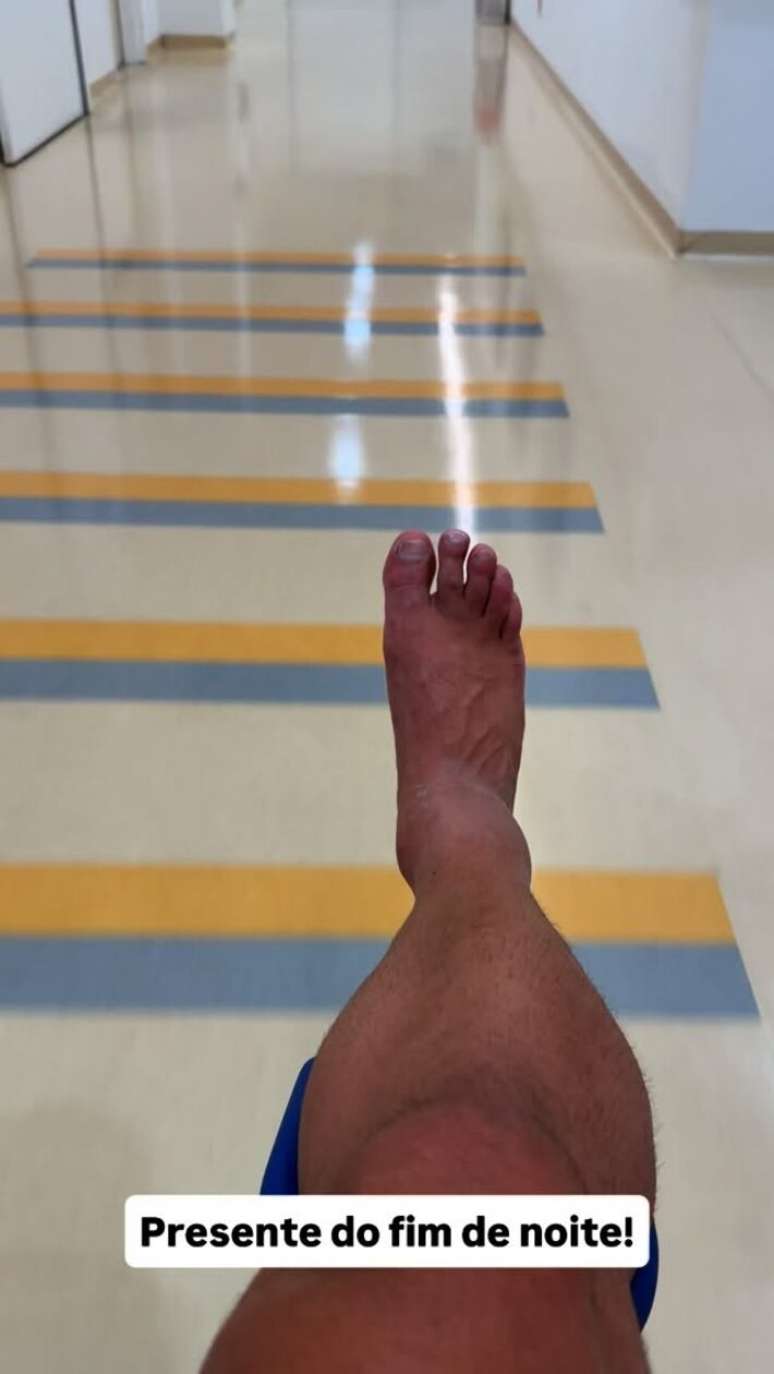 Kaka Diniz was hospitalized after the right ankle injury