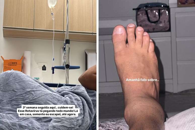 Kaká Diniz, marido da cantora Simone Mendes, publicou foto do tornozelo inchado nas redes sociais