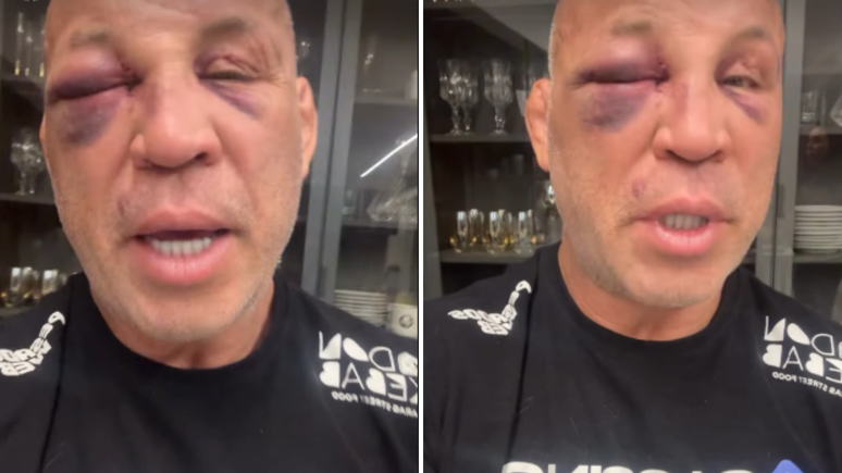 ‘Dois dias e o olho ainda não abriu’, diz Wanderlei Silva