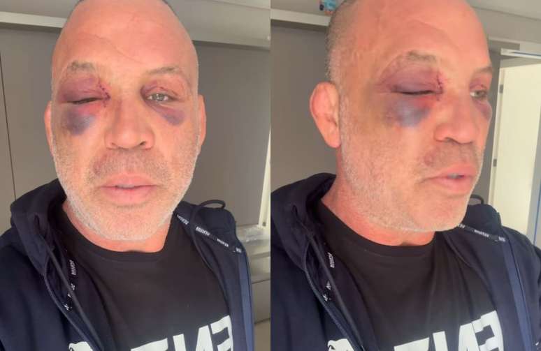 Wanderlei Silva em vídeo publicado nas redes sociais