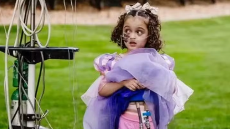 After almost a thousand days in the hospital, the 5 -year -old girl receives an unusual transplant