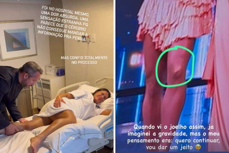 Gracyanne Barbosa mostra sess&atilde;o de fisioterapia | Gracyanne mostra joelho lesionado