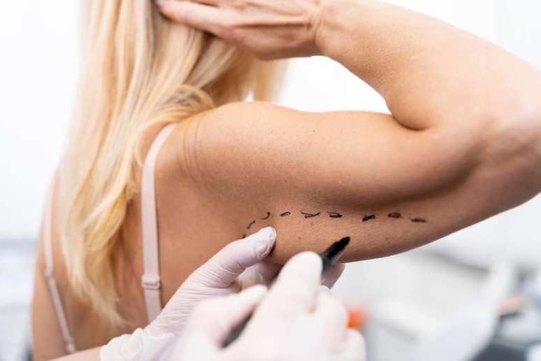 Argeplasma: what it is, when to use and how to compare options