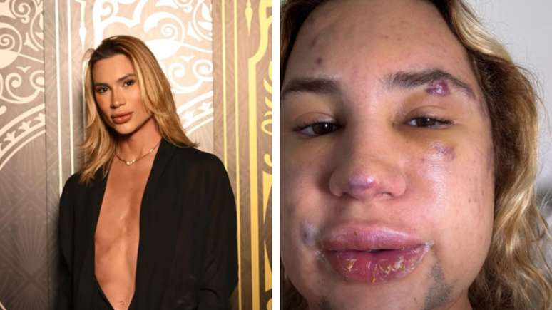Before dying, the influencer revealed and denounced a doctor