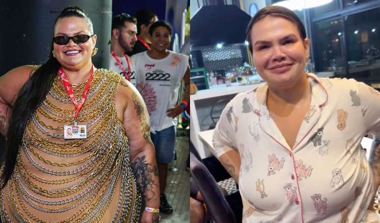 Before and after Thais Carla: 70 kg thinner, the influencer strikes with the new body after the bariatric and defines an important goal in the scale