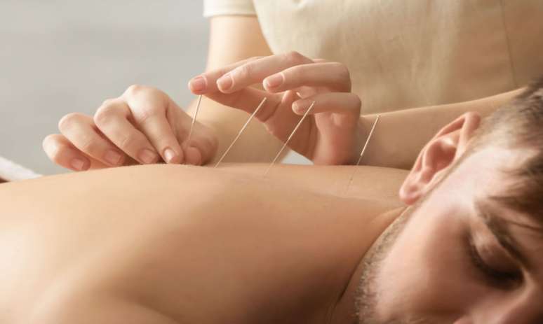 Acupuncture is among the ways to treat chemical dependence