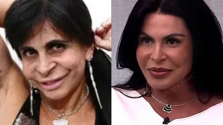 Gretchen detona quem fala sobre sua aparência