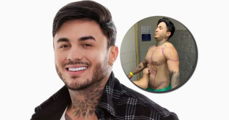 Wallas Arrais recorreu a uma cirurgia para eliminar o excesso de tecido mamário e remodelar o abdômen 