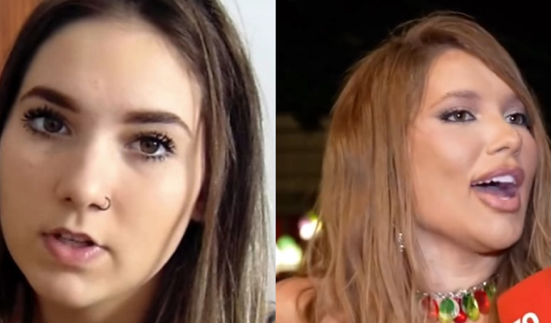 ‘DEFORMED FACE’: Virginia Fonseca’s appearance draws criticism and fans point out excessive cosmetic procedures