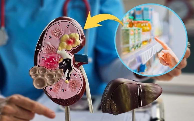 The doctor emphasizes that the worst enemy of liver health is not fat