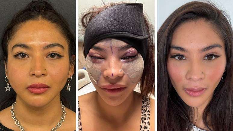 Julia Gilando underwent surgery in Türkiye