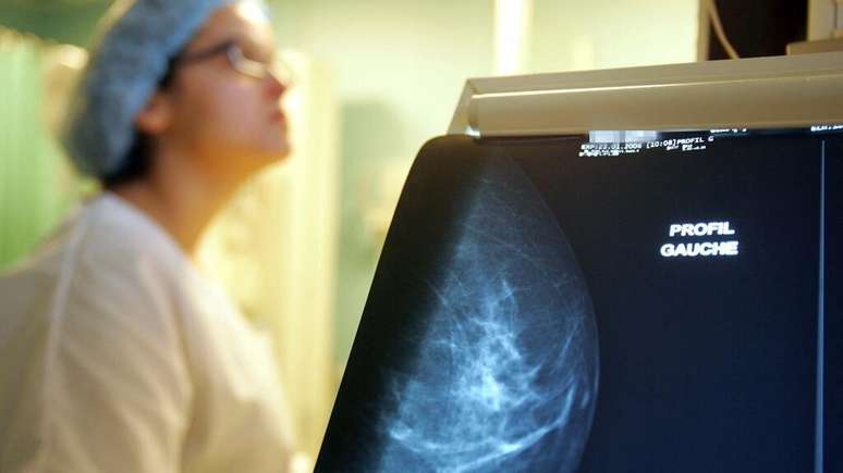 Imagem de mamografia feita no Instituto Curie, em Paris, onde pesquisadores e médicos trabalham para combater o câncer de mama, o tipo mais comum no mundo.