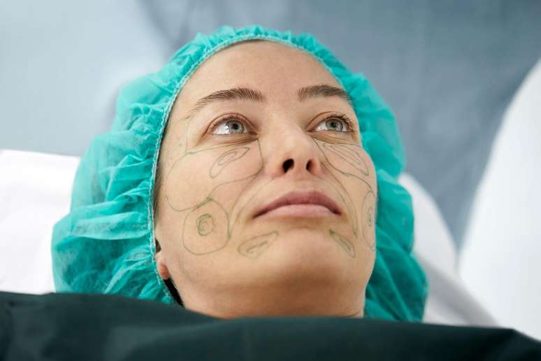 Face lift at 28? Why young people are turning to facial plastic surgery