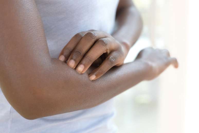We have all scratched ourselves until we left marks. Now science confirms what our mothers told us: it only makes the itching worse