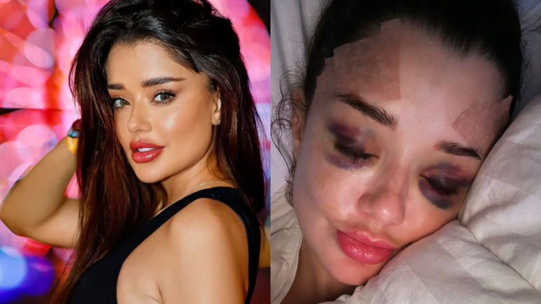 The actress has the same symptoms as the dead influencer and records BO The actress has the same symptoms as the dead influencer and records BO