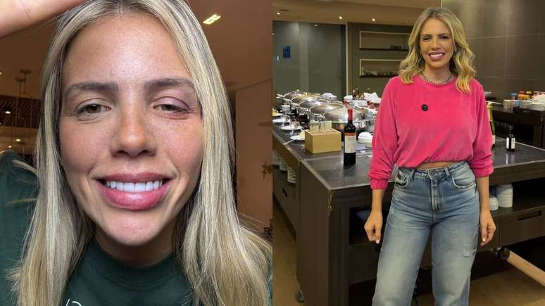The Globo presenter could go blind after the infection The Globo presenter could go blind after the infection