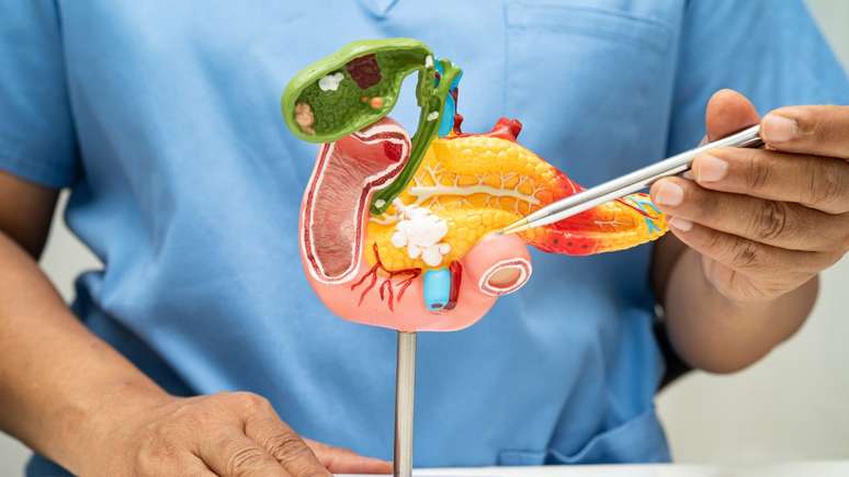 O câncer de pâncreas pode se manifestar com trombose nas pernas e outros sinais sutis; saiba como identificar