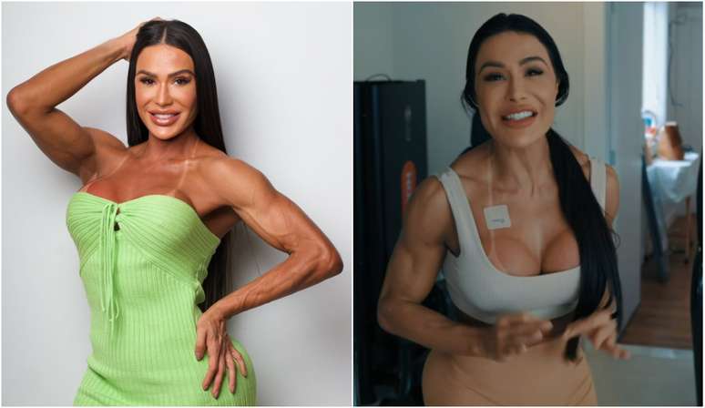 Gracyanne rompeu o tendão do joelho e sofreu mudanças no seu corpo