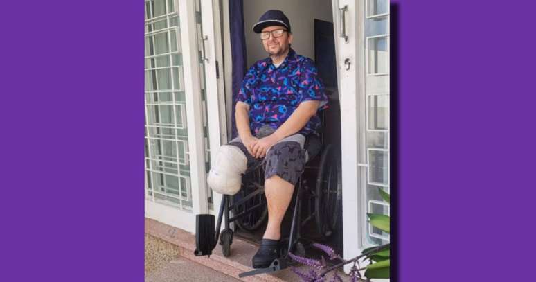 David Castilho revelou o impacto da amputação: "Senti muito medo, mas eu recebi uma onda de amor tão grande que isso me motivou"