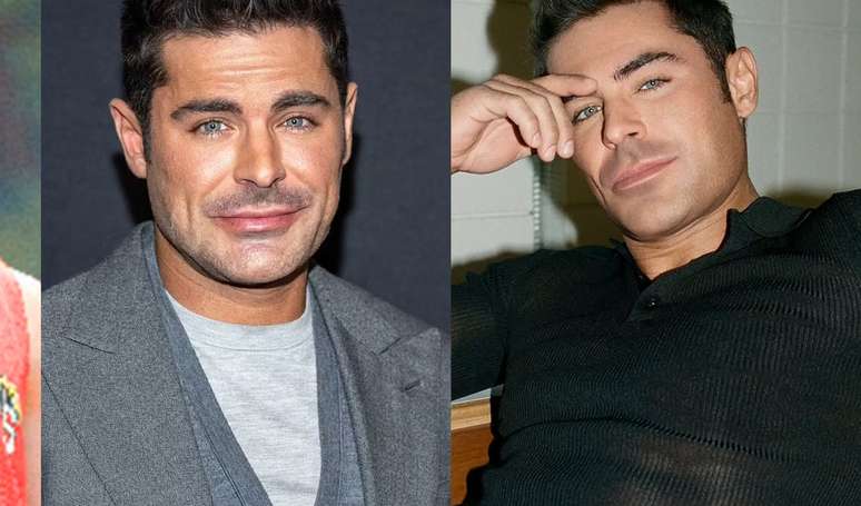 Is Zac Efron handsome again? 20 Before and After Photos of the Actor After Alleged Facial Procedures Is Zac Efron handsome again? 20 Before and After Photos of the Actor After Alleged Facial Procedures