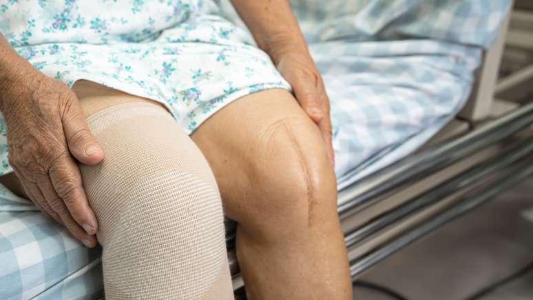 A osteoporose &eacute; classificada como uma condi&ccedil;&atilde;o cl&iacute;nica que, segundo dados da Organiza&ccedil;&atilde;o Mundial da Sa&uacute;de (OMS), atinge mais de 15 milh&otilde;es de indiv&iacute;duos no Brasil