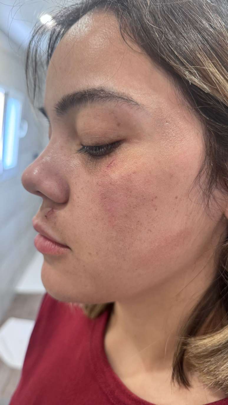 Jovem de 26 anos estava em vagão vazio; dias após ataque rosto da vítima continuava inchado