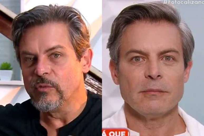 Before and after! Luigi Baricelli surprises a lot after having achieved facial harmonization Before and after! Luigi Baricelli surprises a lot after having achieved facial harmonization