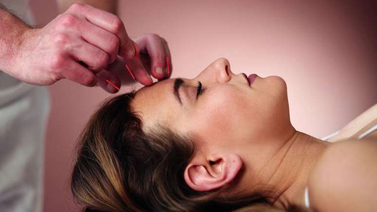 How acupuncture can help in psychological treatment How acupuncture can help in psychological treatment