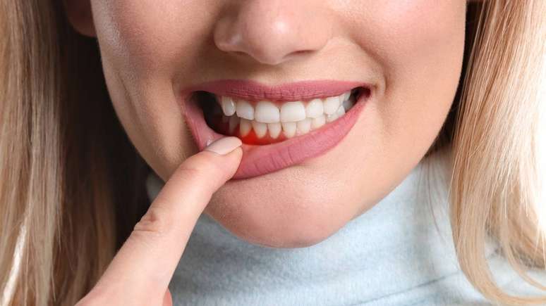 Visiting the dentist regularly is important to maintain oral health – depositphotos.com/serezniy Visiting the dentist regularly is important to maintain oral health – depositphotos.com/serezniy
