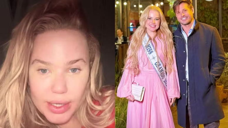 Dado Dolabella’s girlfriend justifies the bruises after the loss: ‘There is a couple’s quarrel’ Dado Dolabella’s girlfriend justifies the bruises after the loss: ‘There is a couple’s quarrel’