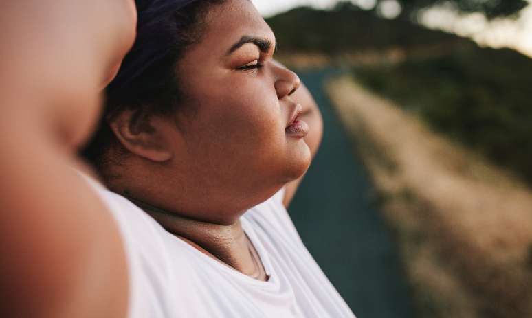 Obesity can lead to blindness, research says Obesity can lead to blindness, research says