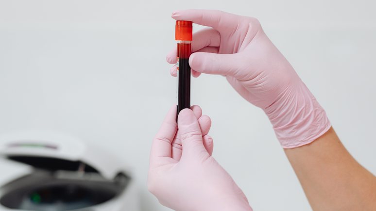 Blood tests facilitate early diagnosis and treatment of Alzheimer’s; learn more Blood tests facilitate early diagnosis and treatment of Alzheimer’s; learn more