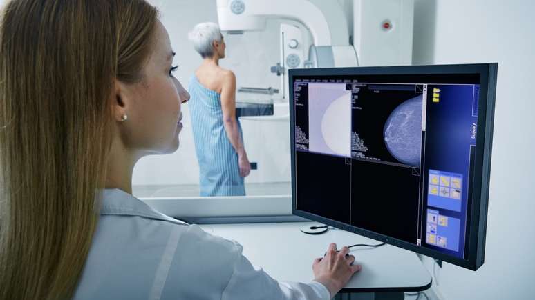 Bill guarantees mammography through SUS from age 40 Bill guarantees mammography through SUS from age 40