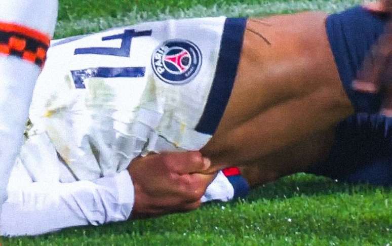 Dou&eacute; teve uma les&atilde;o muscular na coxa direita &ndash;