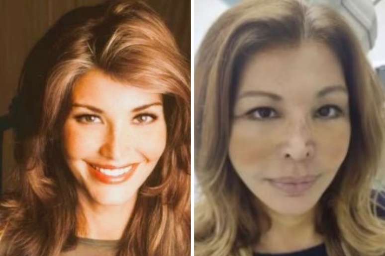 Muse of the 80s, Roberta Close surrenders to aesthetic procedures; see the result