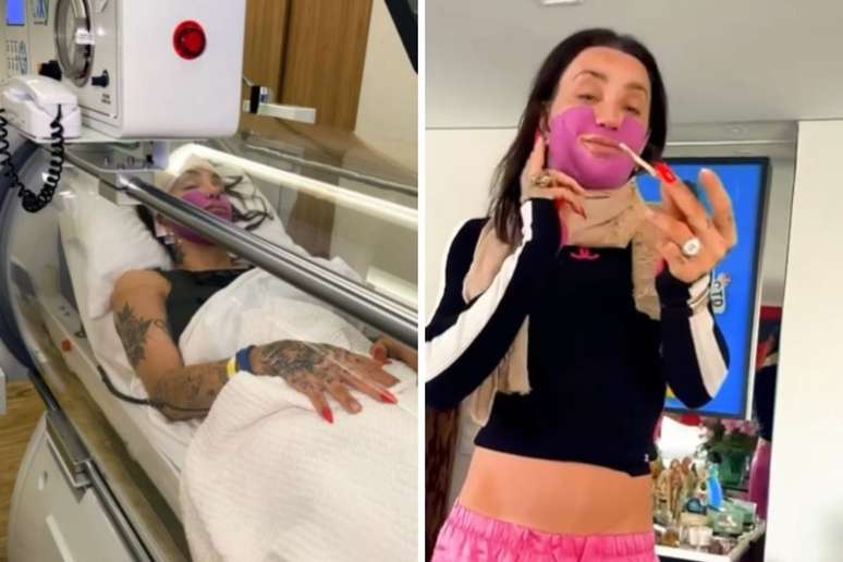 Maya Massafera se submete e a cirurgia e mostra osso retirado logo ap&oacute;s